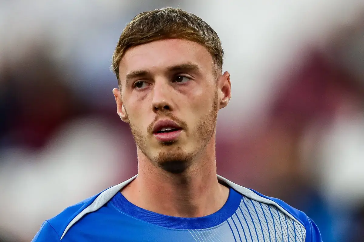 Palmer injury being assessed after Chelsea star misses derby win